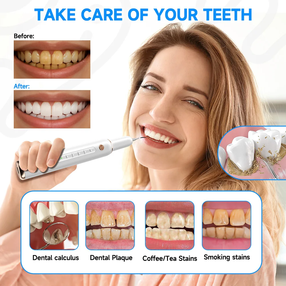 CURVY MOON T4 Portable Ultrasonic Electric Toothbrush Professional Plaque Calculus Removal Tooth Stains Remover Cleaning Tools