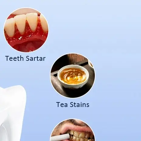 Ultrasonic Dental Scaler Scaler Tooth Cleaner Dental Stone Removal Electric Sonic Plaque Remover for Teeth Stain Tartar