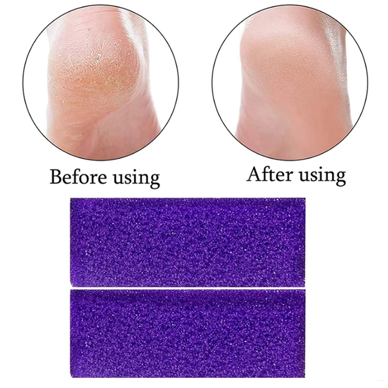 【Best Selling】5 Piece Reusable Pumice Sponge Kit - Hard Skin Exfoliator And Callus Scrubber For Pedicure And Foot Care